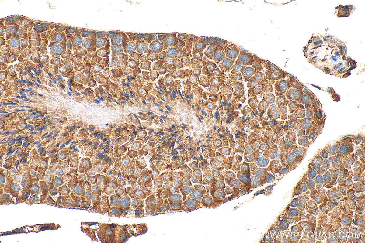 IHC staining of mouse testis using 18540-1-AP