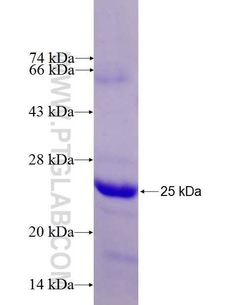 DNAJB9 fusion protein Ag27432 SDS-PAGE DNAJB9 fusion protein Ag27432 SDS-PAGE