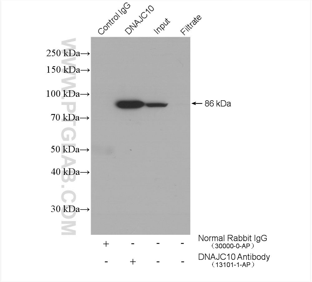 IP experiment of HeLa using 13101-1-AP