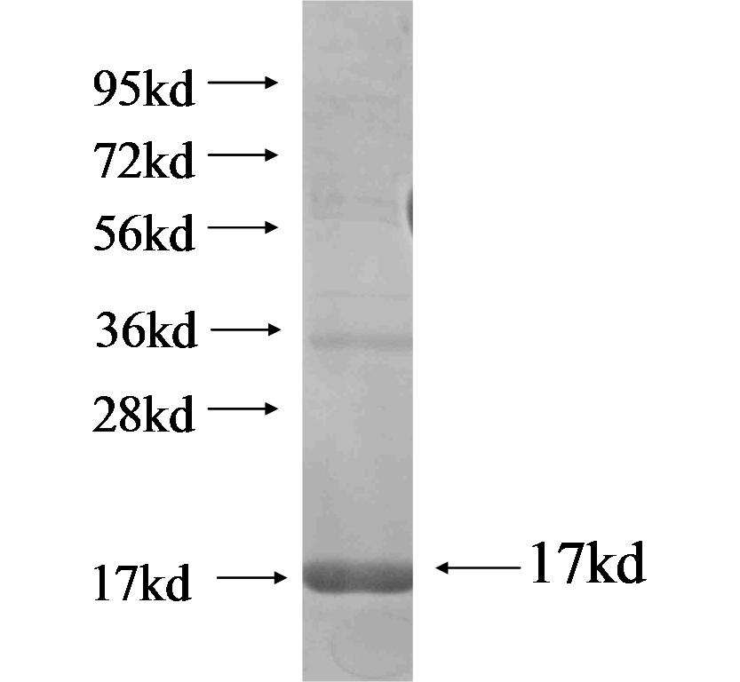 DNAJC10 fusion protein Ag18099 SDS-PAGE