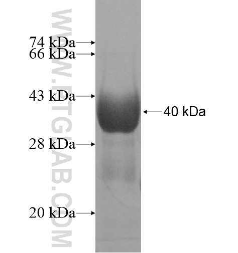 DNAJC11 fusion protein Ag11323 SDS-PAGE DNAJC11 fusion protein Ag11323 SDS-PAGE
