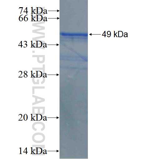 DNAJC12 fusion protein Ag2989 SDS-PAGE
