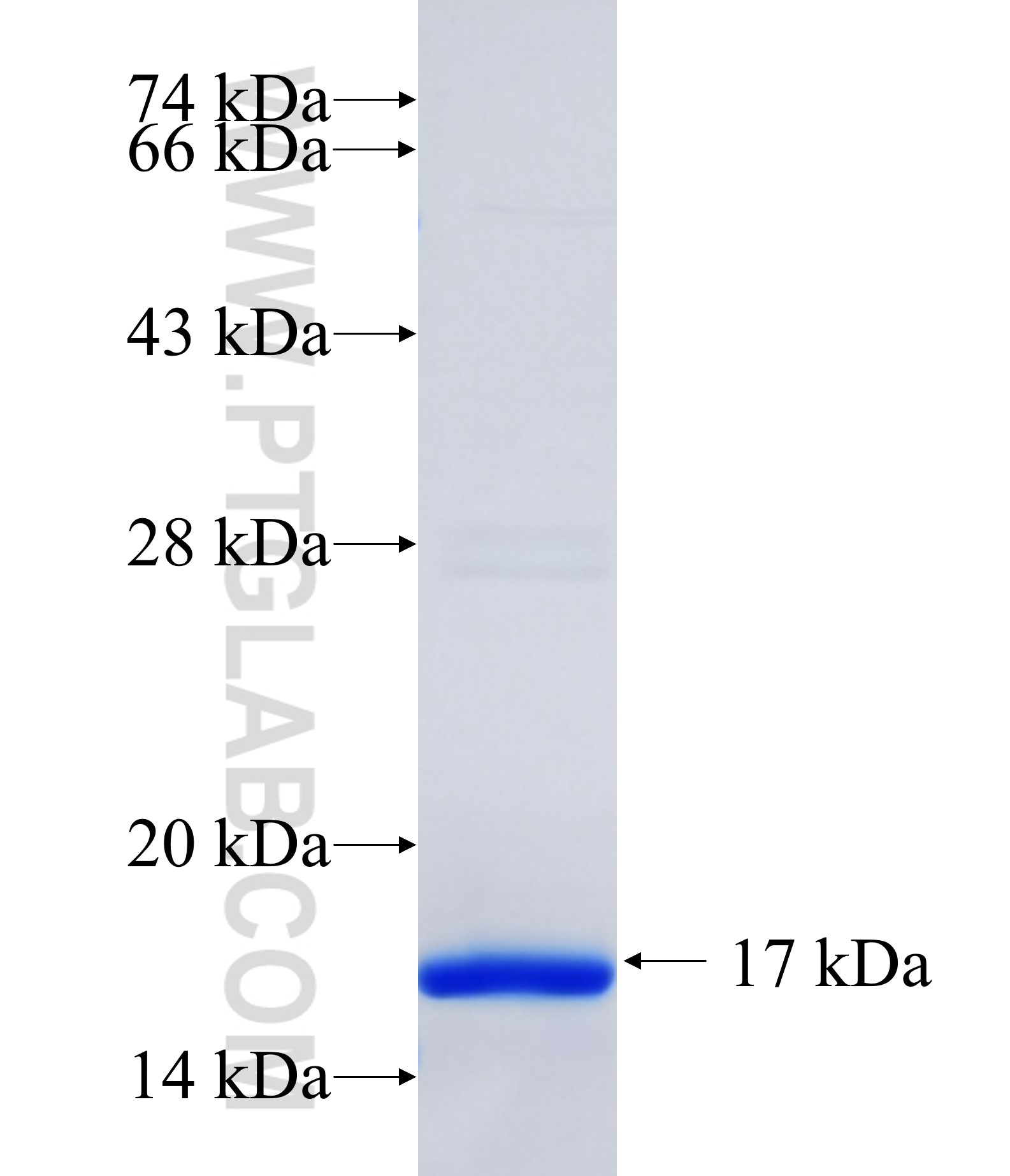 DNAJC13 fusion protein Ag35504 SDS-PAGE DNAJC13 fusion protein Ag35504 SDS-PAGE
