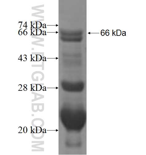 DNAJC14 fusion protein Ag2893 SDS-PAGE DNAJC14 fusion protein Ag2893 SDS-PAGE