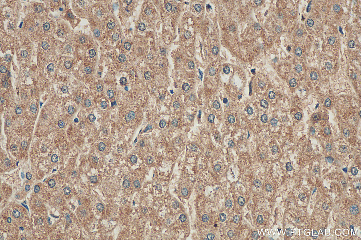 IHC staining of human liver using 16063-1-AP