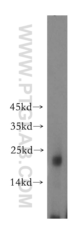 WB analysis of mouse liver using 16063-1-AP