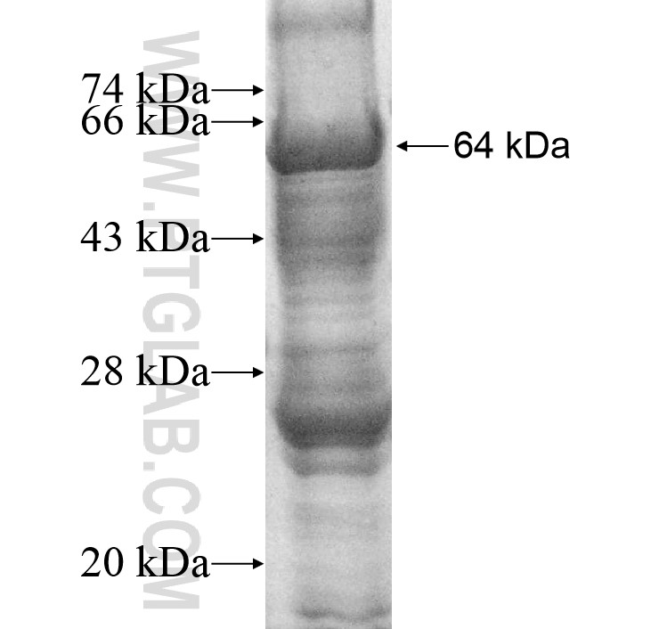 DNAJC16 fusion protein Ag11513 SDS-PAGE DNAJC16 fusion protein Ag11513 SDS-PAGE
