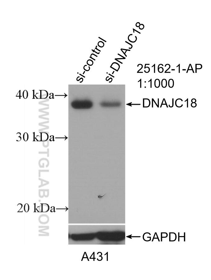 WB analysis of A431 using 25162-1-AP