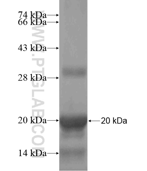 DNAJC18 fusion protein Ag18711 SDS-PAGE DNAJC18 fusion protein Ag18711 SDS-PAGE