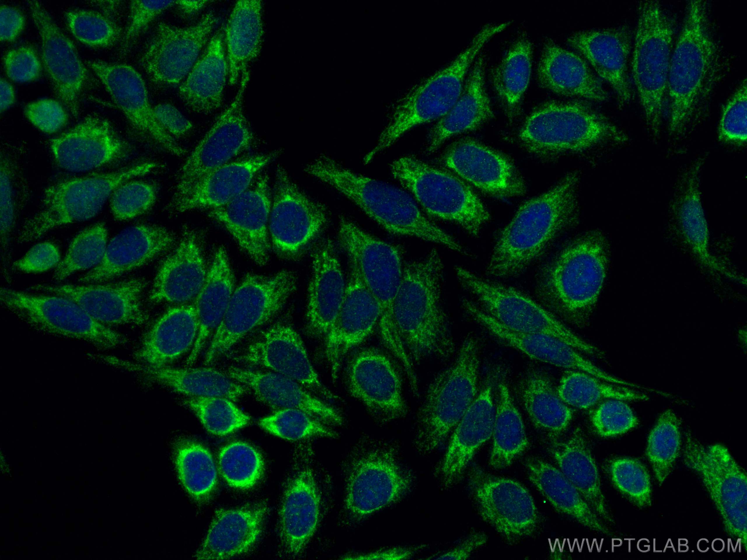 IF Staining of HepG2 using 12096-1-AP