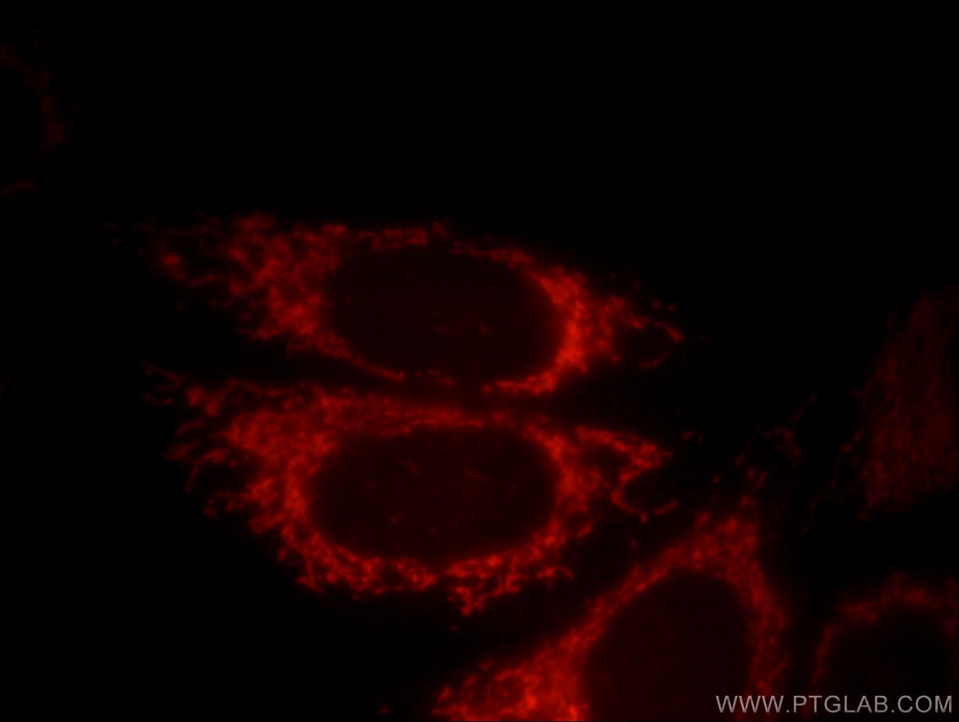 IF Staining of HepG2 using 12096-1-AP