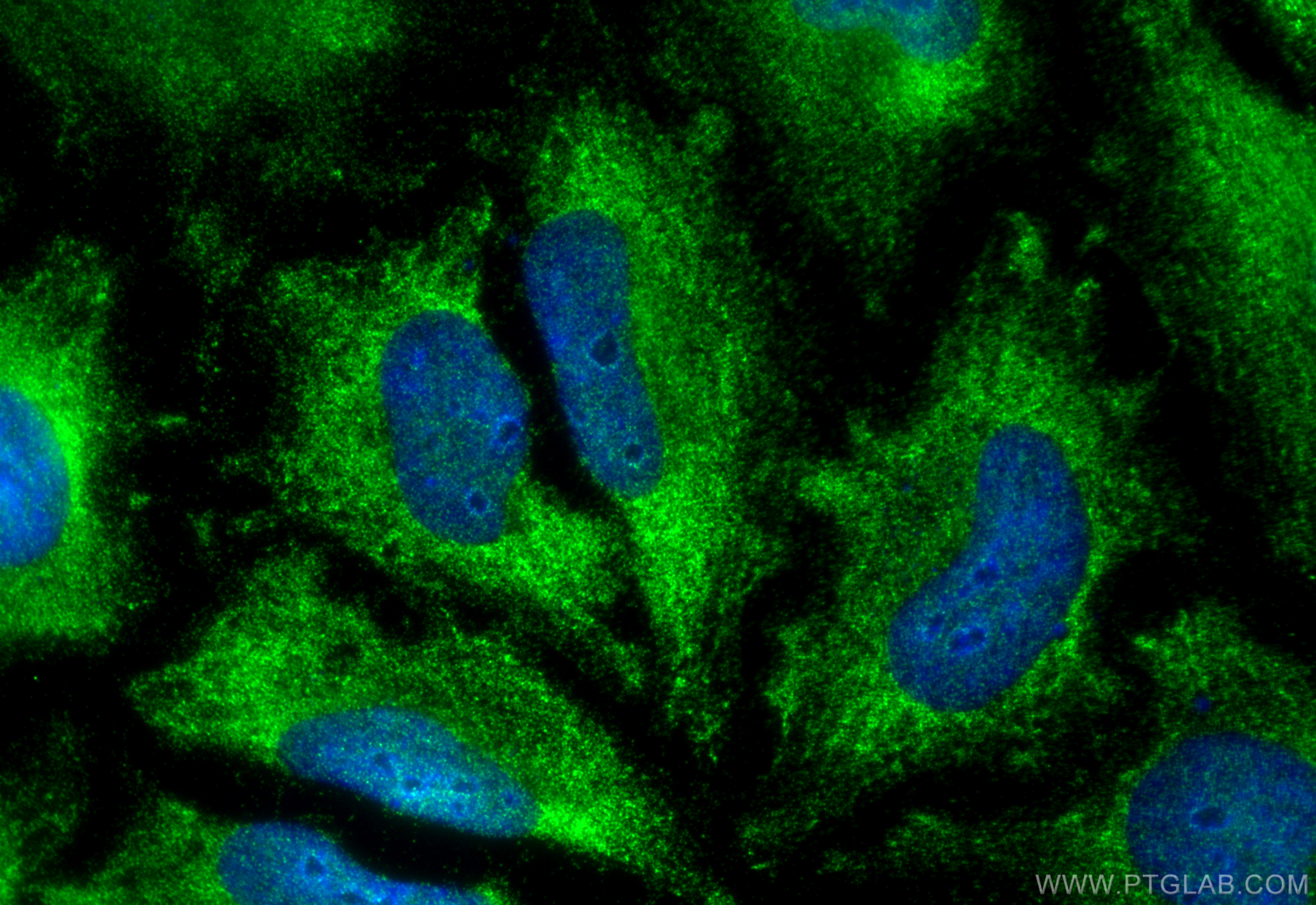 IF Staining of HeLa using 11971-1-AP