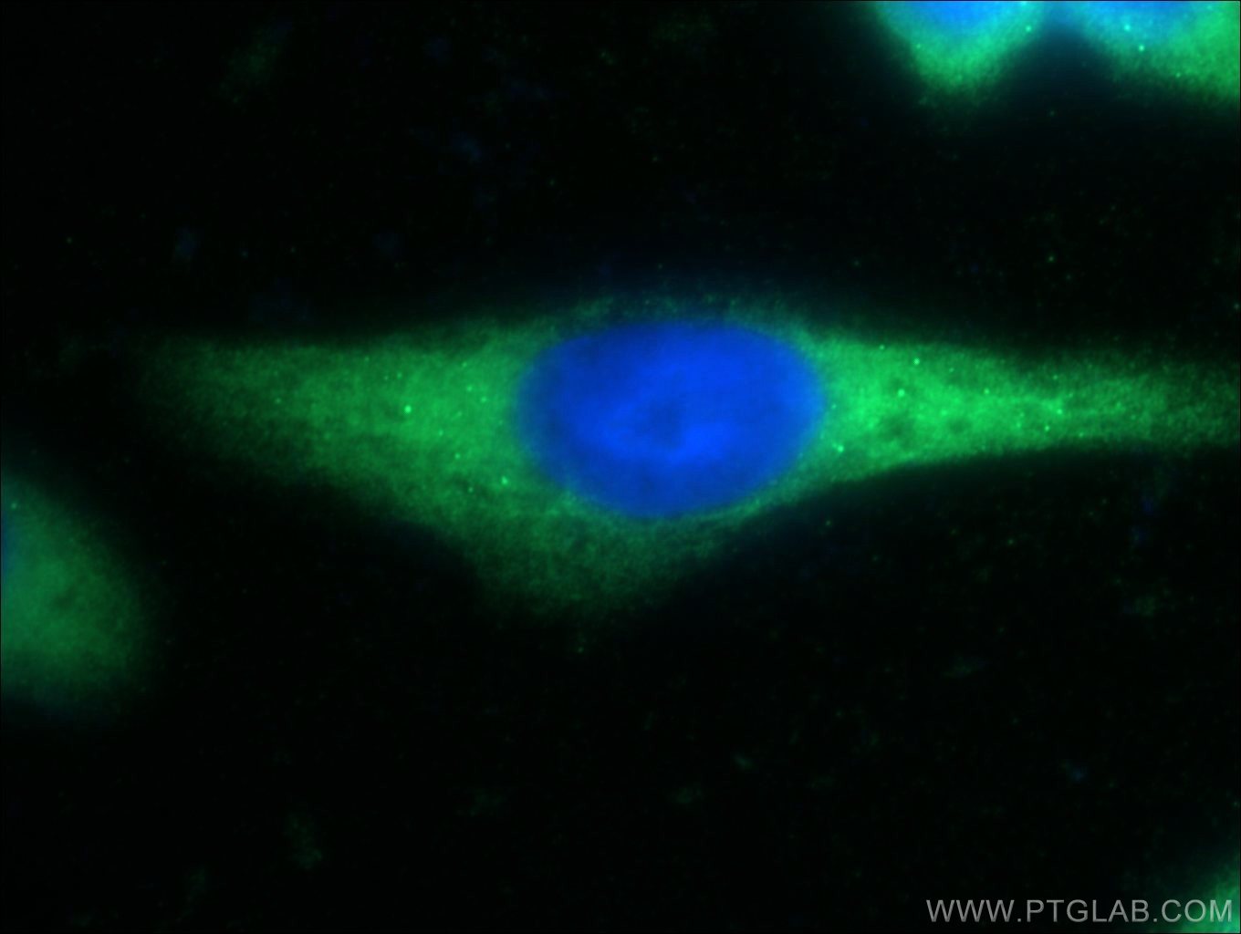 IF Staining of HeLa using 23411-1-AP