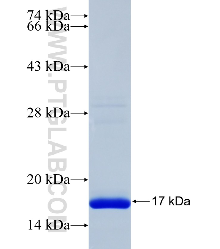 DNAJC22 fusion protein Ag38322 SDS-PAGE DNAJC22 fusion protein Ag38322 SDS-PAGE