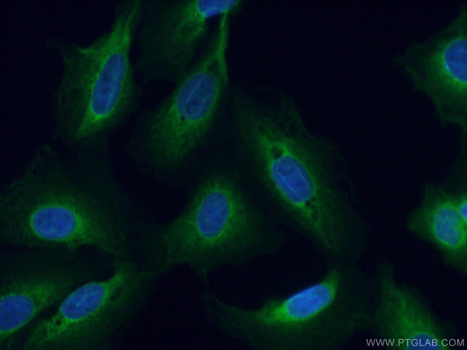 IF Staining of U2OS using 26721-1-AP