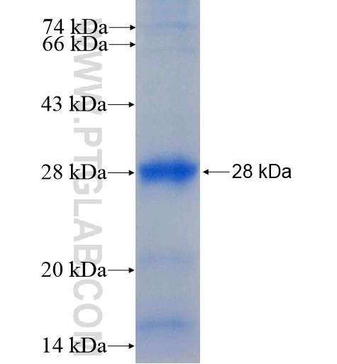 DNAJC30 fusion protein Ag15207 SDS-PAGE DNAJC30 fusion protein Ag15207 SDS-PAGE