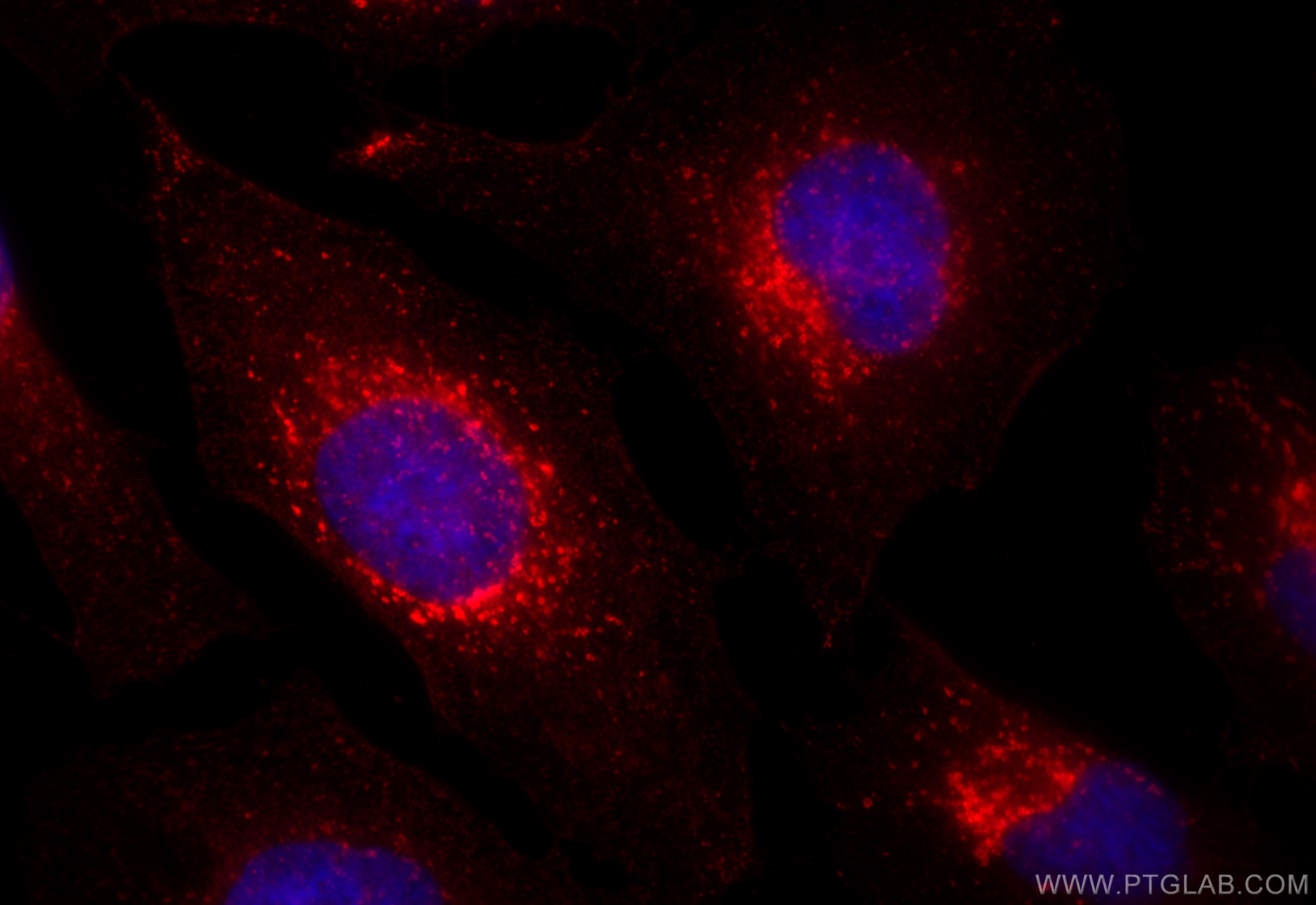 IF Staining of HeLa using 32204-1-AP