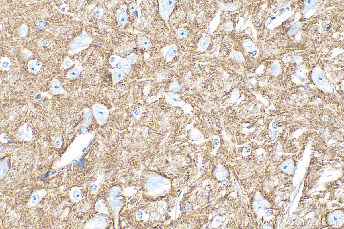 IHC staining of mouse cerebellum using 32204-1-AP