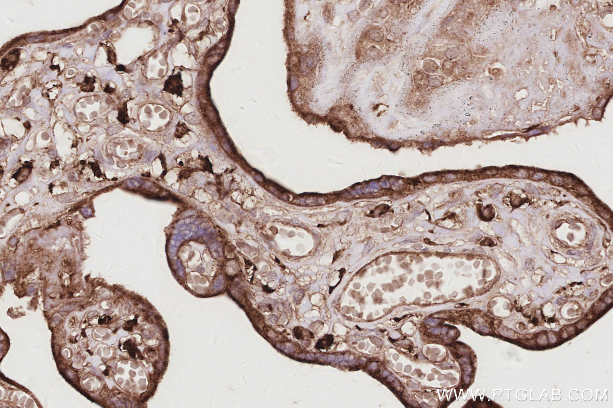 IHC staining of human placenta using 32204-1-AP