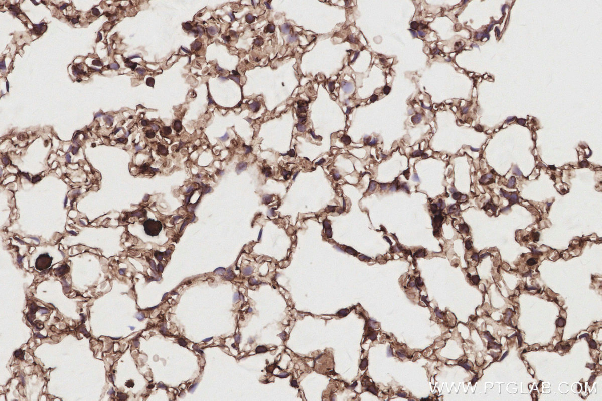 IHC staining of mouse lung using 32204-1-AP