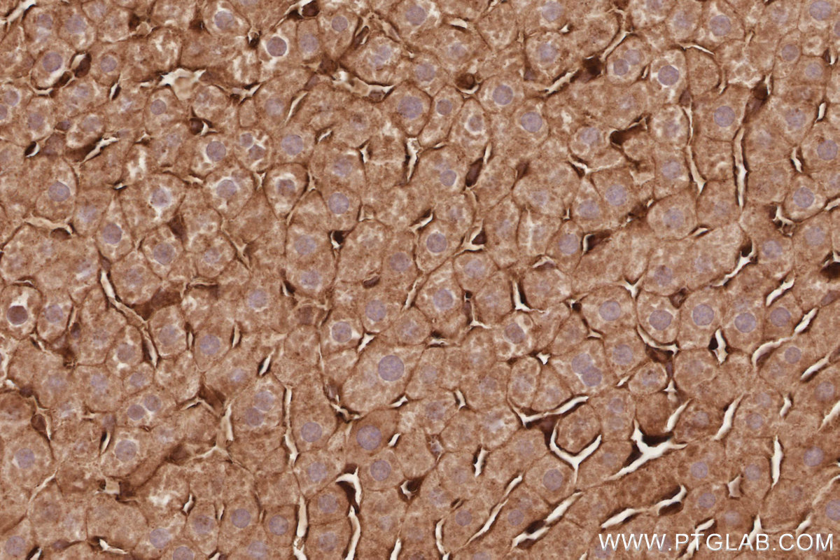 IHC staining of rat liver using 32204-1-AP