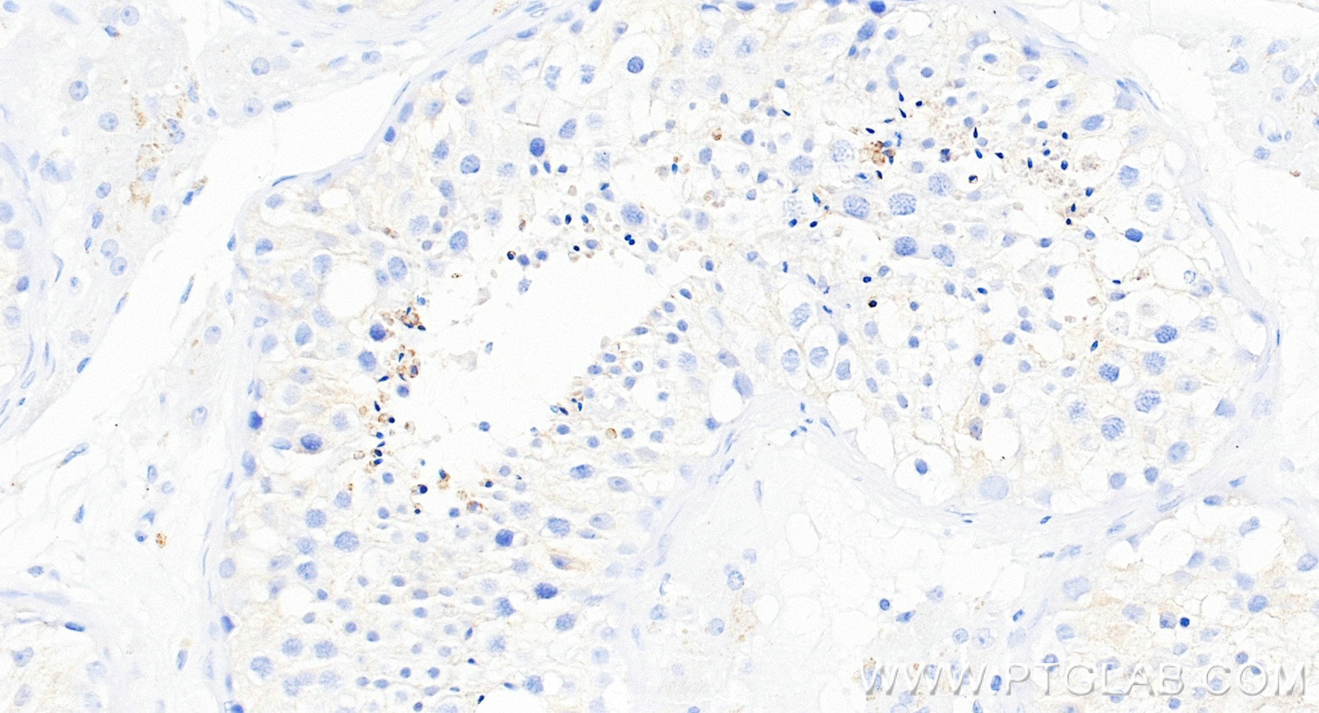 IHC staining of human testis using 86975-4-RR (same clone as 86975-4-PBS) IHC staining of human testis using 86975-4-RR (same clone as 86975-4-PBS)