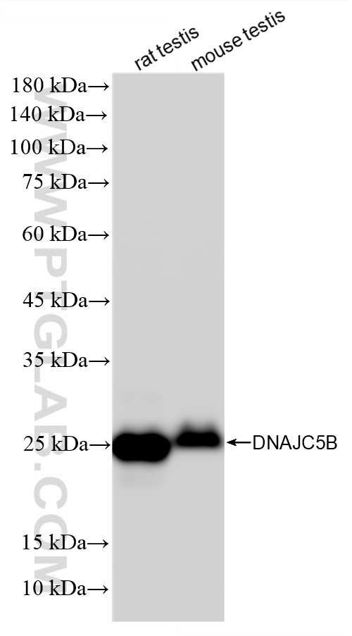 Various lysates were subjected to SDS PAGE followed by western blot with 86975-4-RR (DNAJC5B antibody) at dilution of 1:5000 incubated at room temperature for 1.5 hours. WB analysis using 86975-4-RR