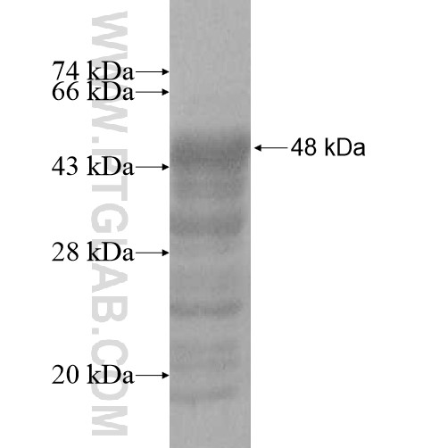 DNAJC5B fusion protein Ag10769 SDS-PAGE DNAJC5B fusion protein Ag10769 SDS-PAGE