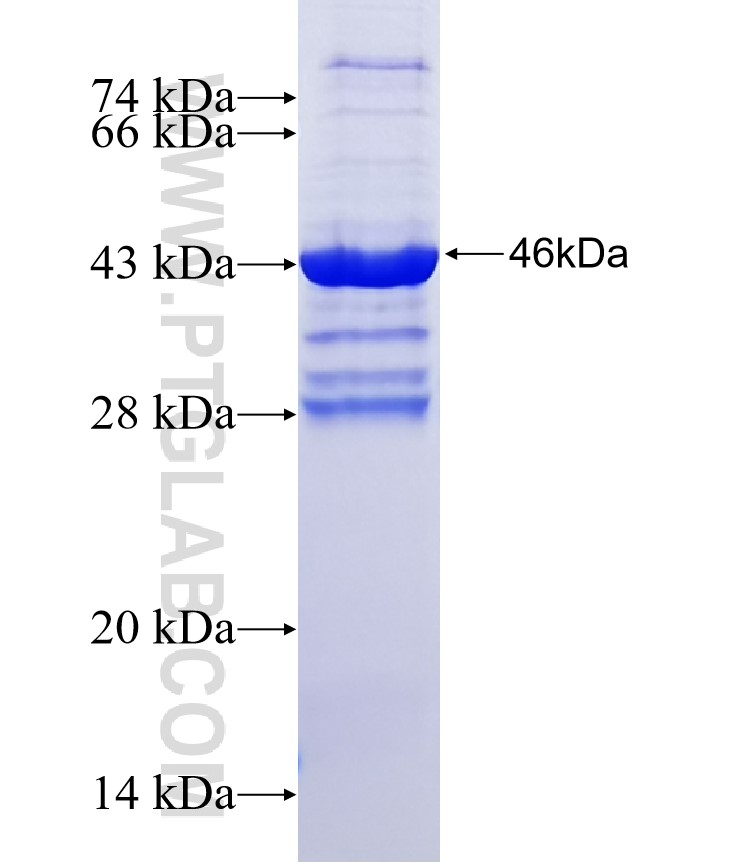 DNAJC5G fusion protein Ag11748 SDS-PAGE DNAJC5G fusion protein Ag11748 SDS-PAGE