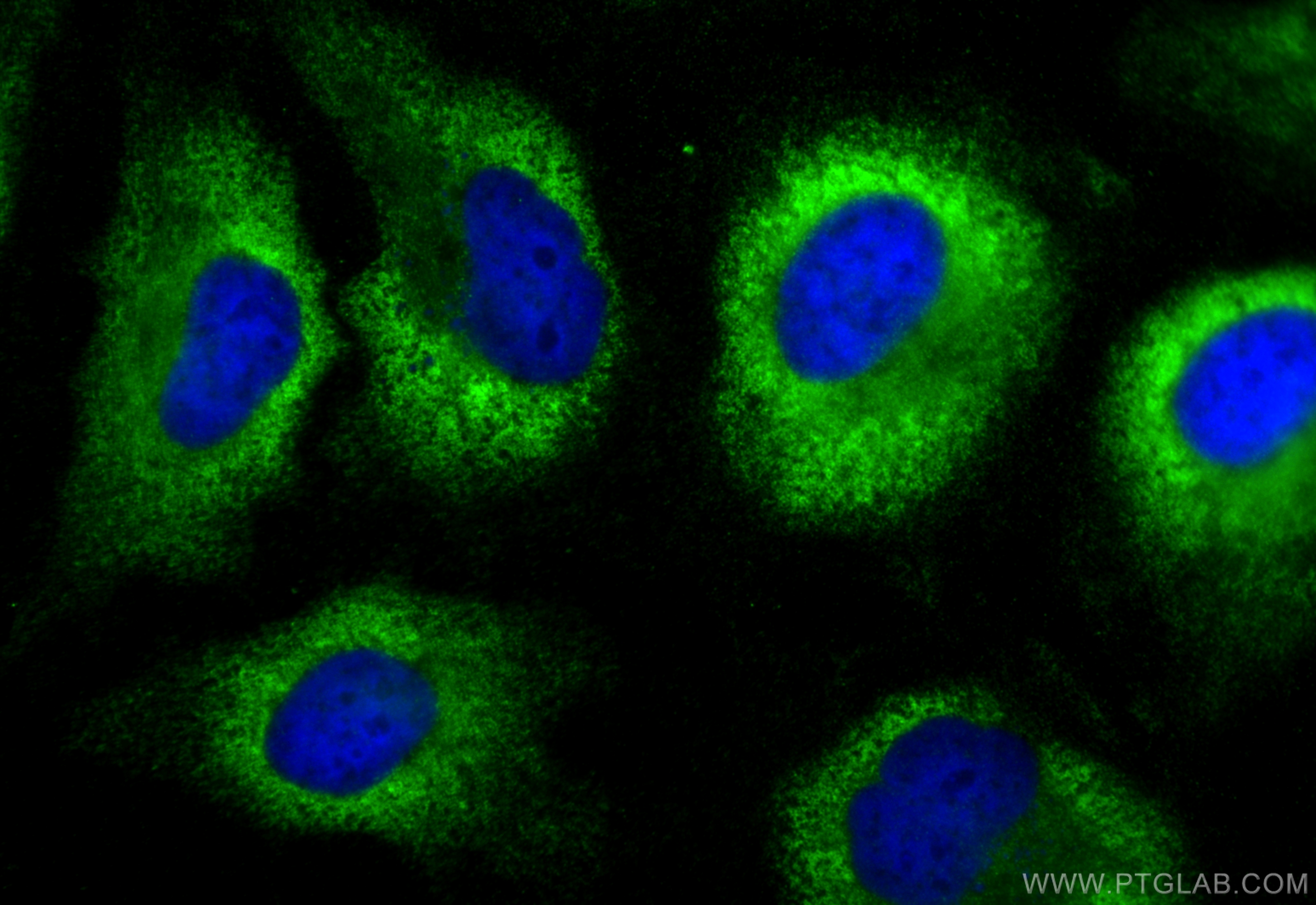 IF Staining of HeLa using 21941-1-AP