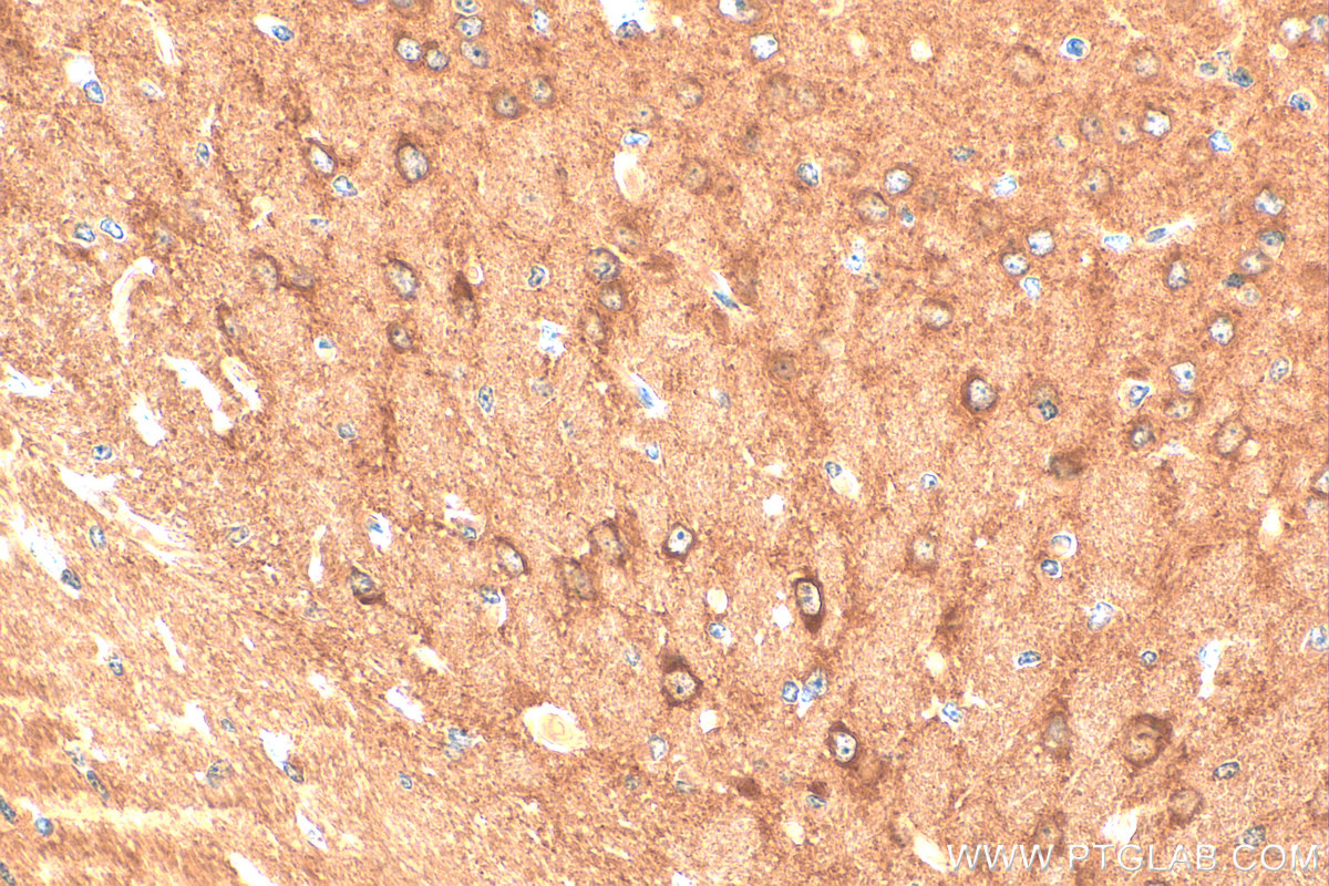 IHC staining of mouse brain using 21941-1-AP