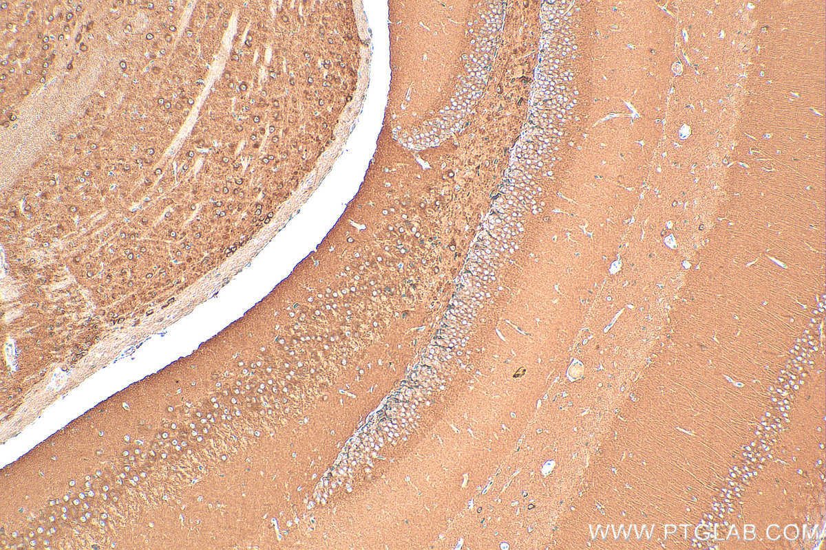 IHC staining of mouse brain using 21941-1-AP