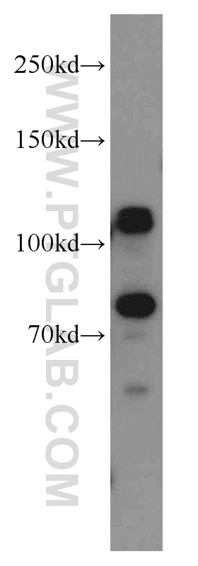 WB analysis of HeLa using 21941-1-AP