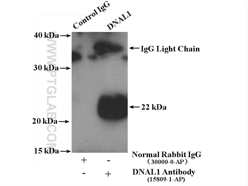 IP experiment of HeLa using 15809-1-AP