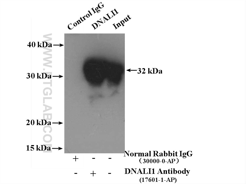 IP experiment of mouse testis using 17601-1-AP