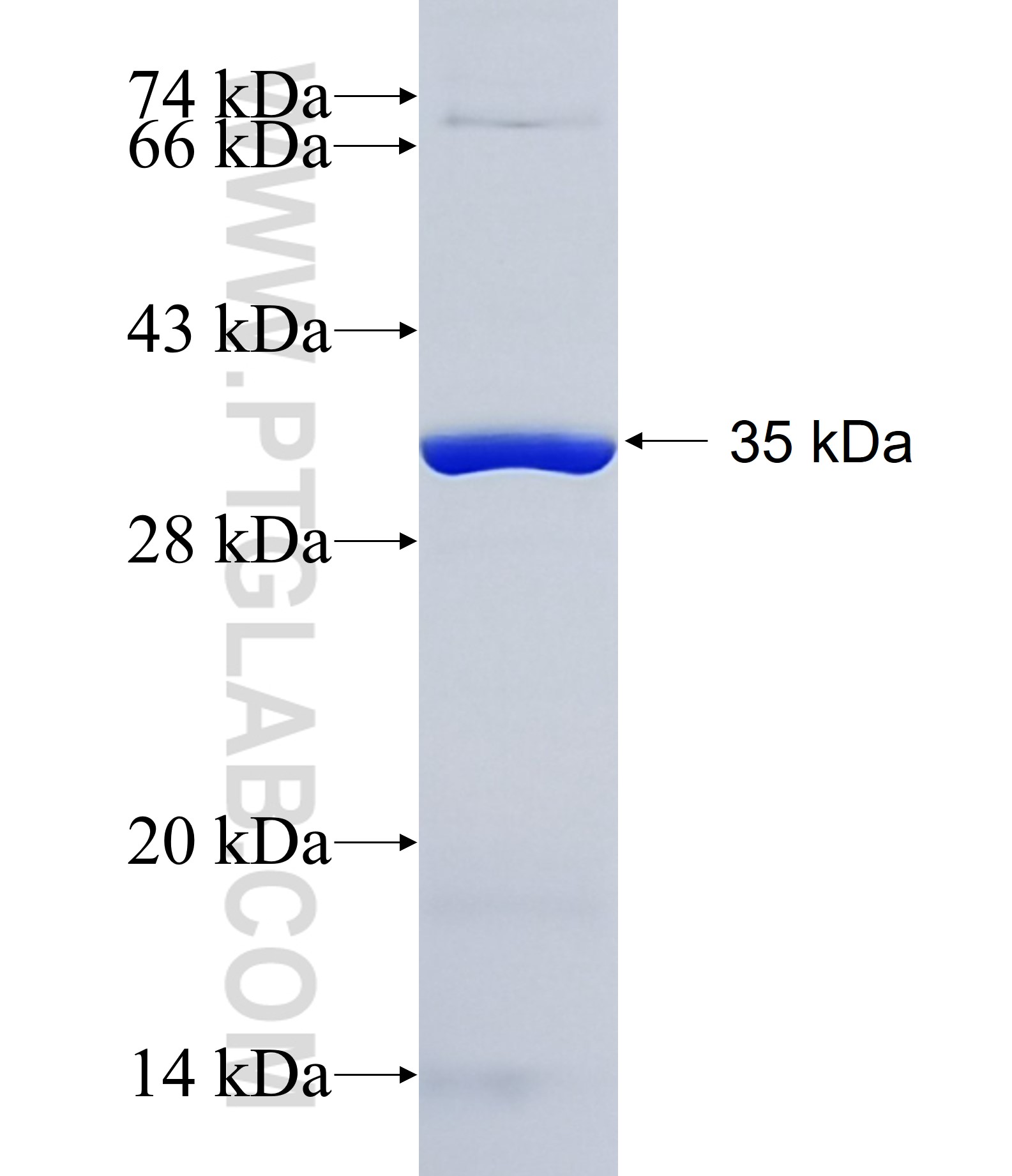 DNASE1L2 fusion protein Ag11270 SDS-PAGE