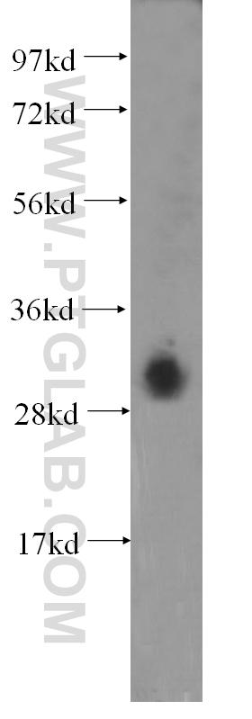 WB analysis of HEK-293 using 11330-1-AP