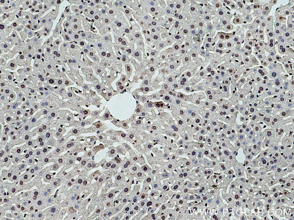IHC staining of mouse liver using 67041-1-Ig