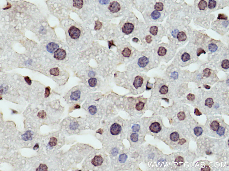 IHC staining of mouse liver using 67041-1-Ig