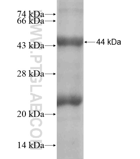 DNASE2B fusion protein Ag18595 SDS-PAGE DNASE2B fusion protein Ag18595 SDS-PAGE