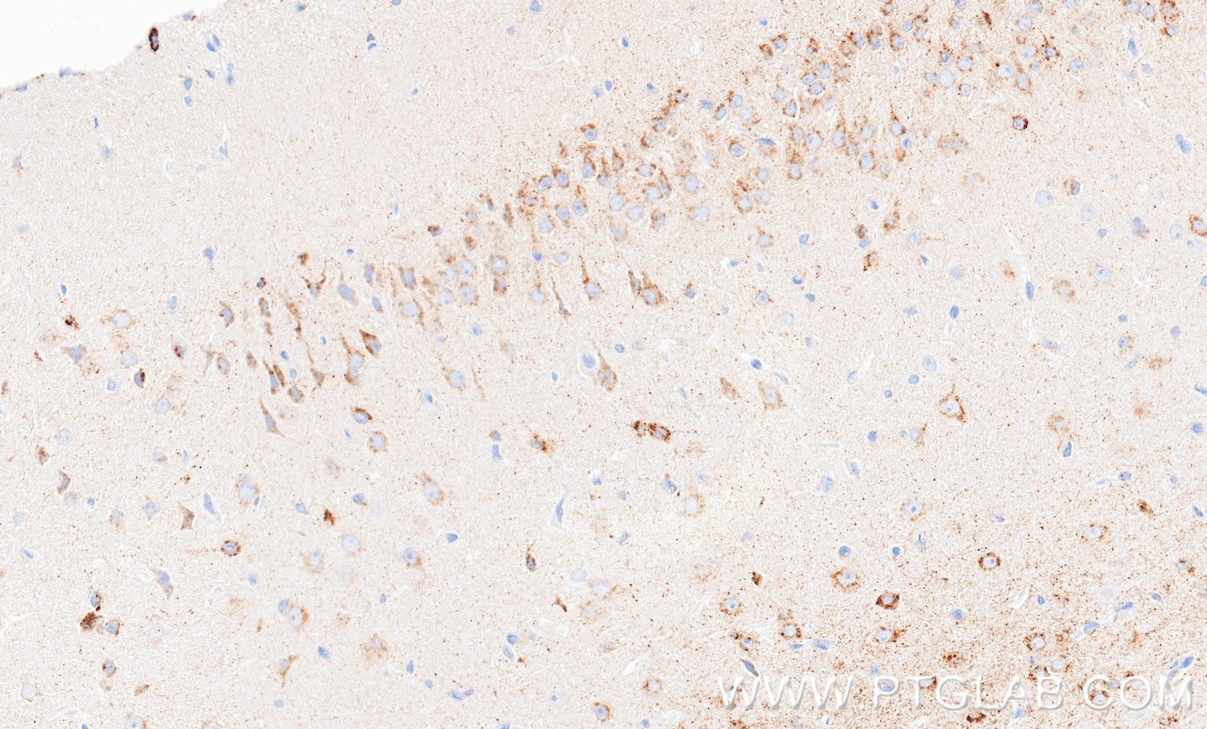 IHC staining of mouse brain using 87343-1-RR (same clone as 87343-1-PBS) IHC staining of mouse brain using 87343-1-RR (same clone as 87343-1-PBS)
