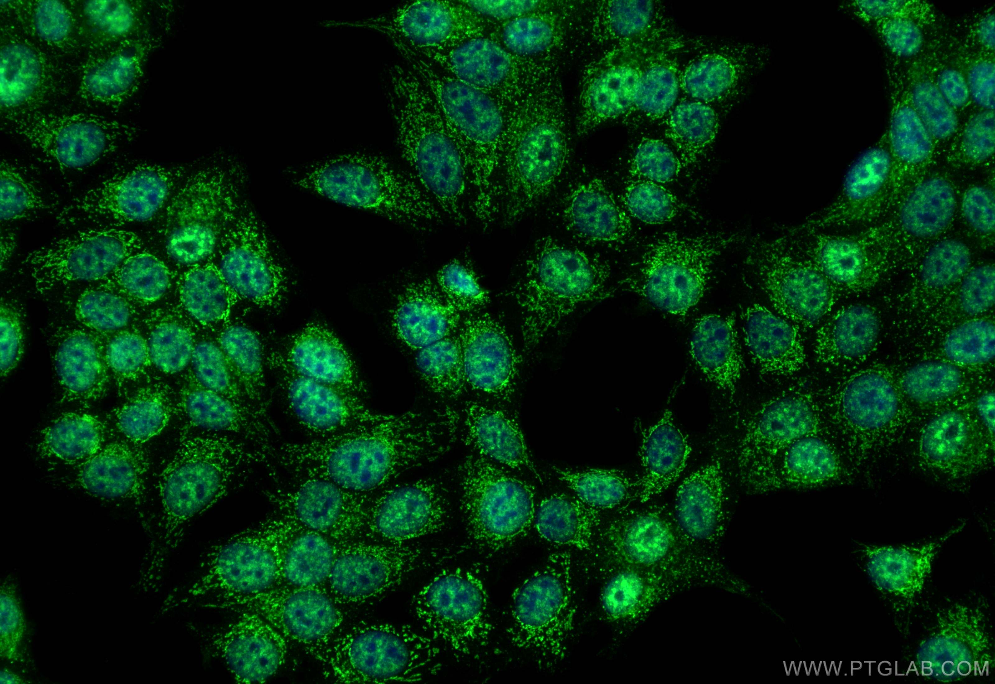IF Staining of MCF-7 using 31844-1-AP