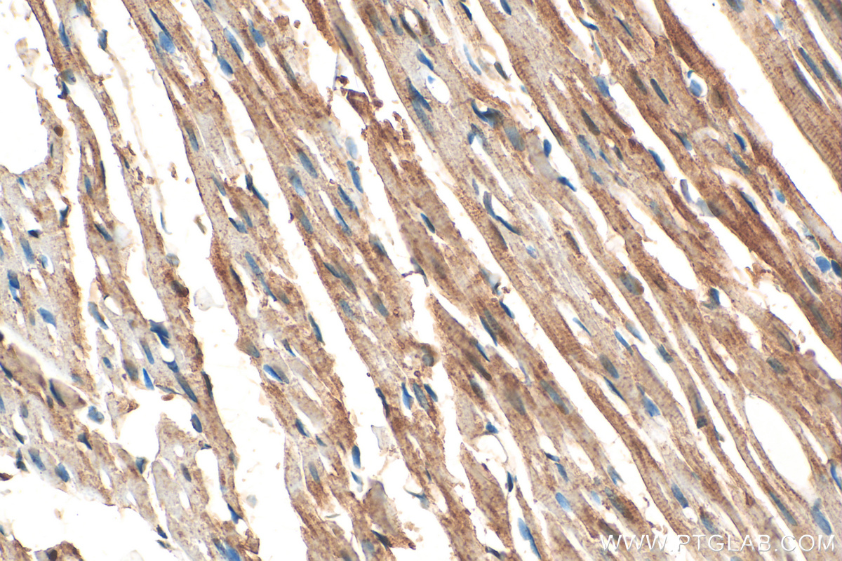 IHC staining of rat heart using 31844-1-AP