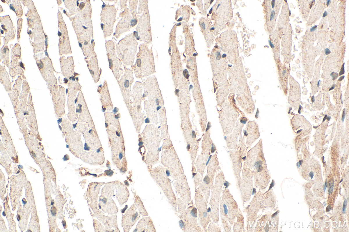 IHC staining of mouse heart using 31844-1-AP