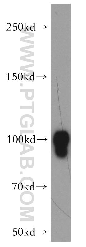 Dynamin 1 Polyclonal antibody