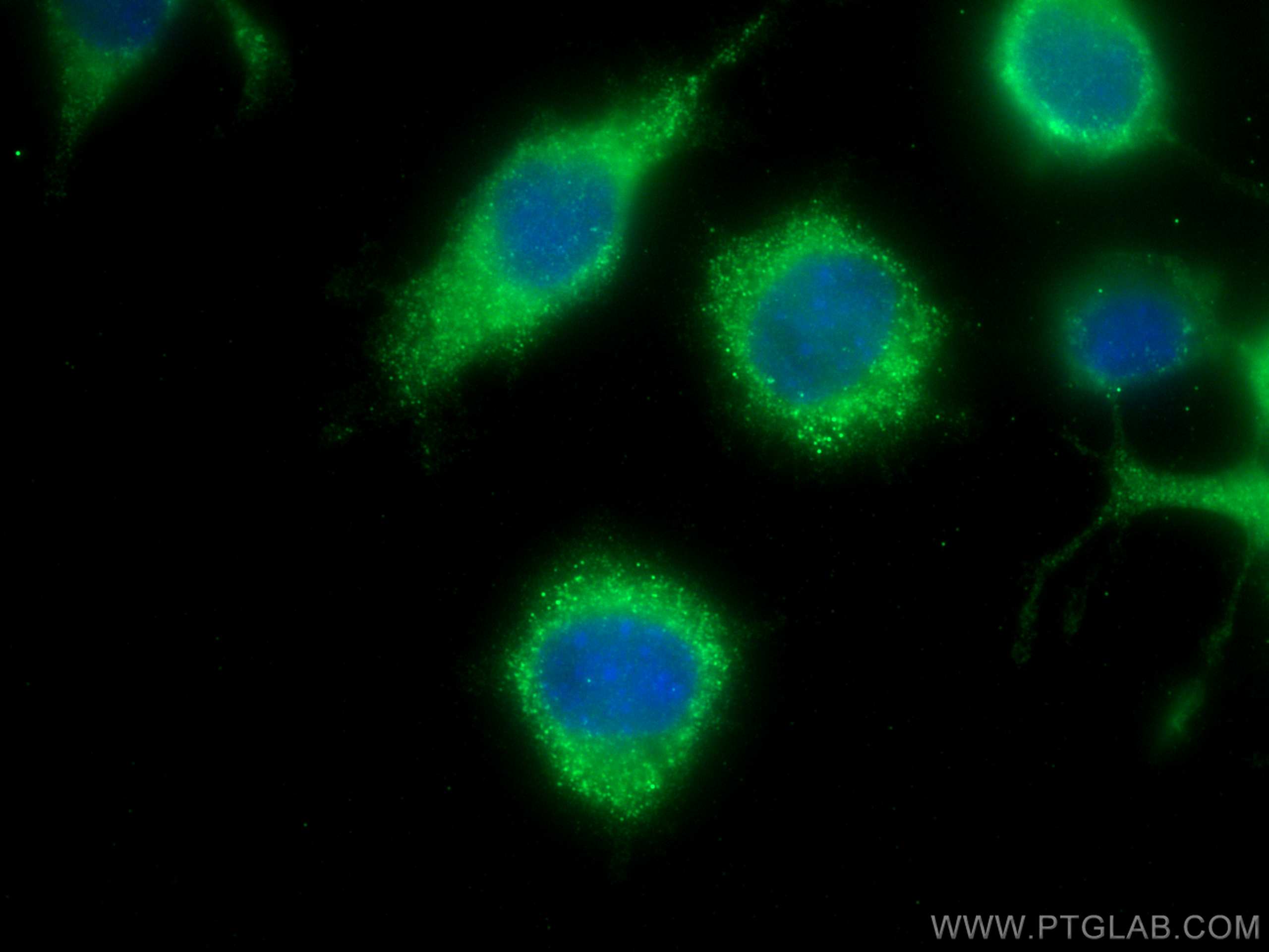 IF Staining of Neuro-2a using 68009-1-Ig