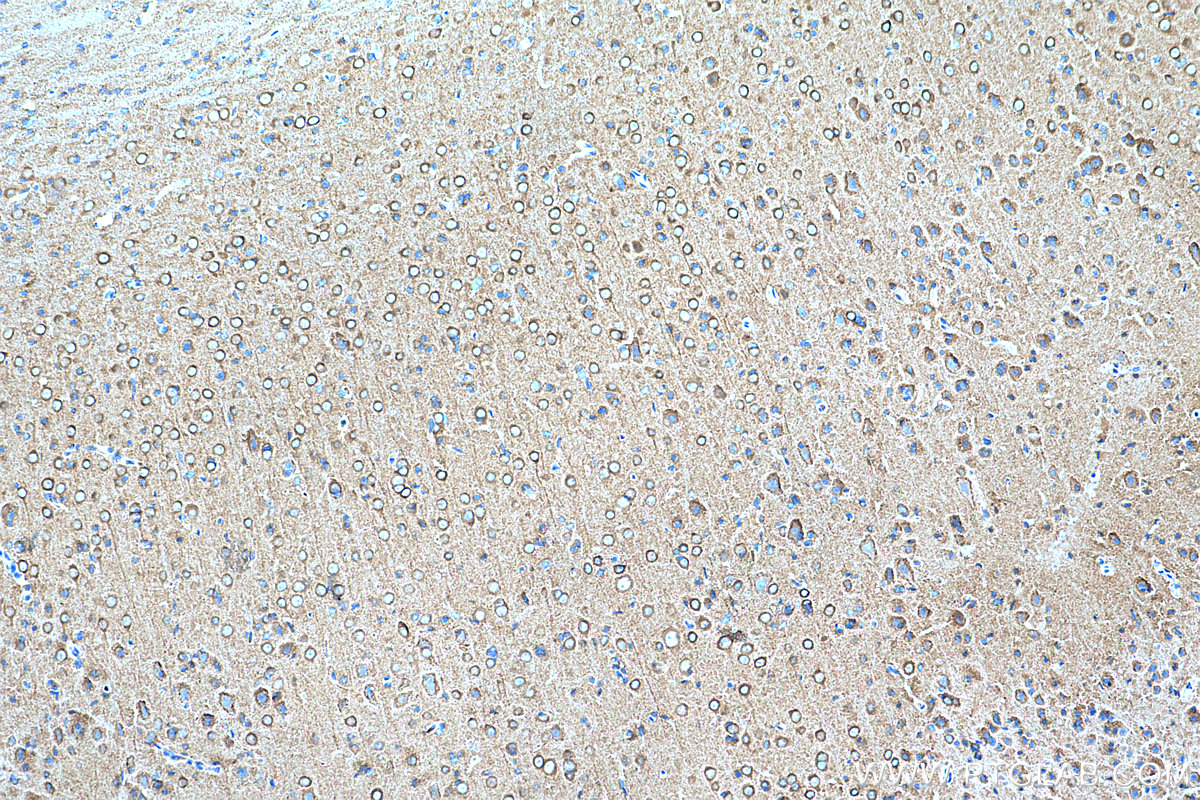 IHC staining of rat brain using 68009-1-Ig