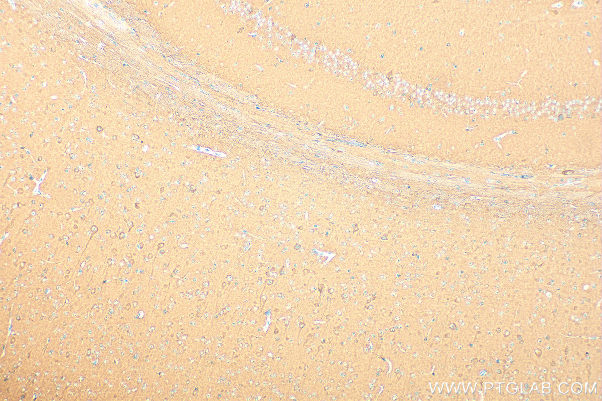 Immunohistochemical analysis of paraffin-embedded mouse brain tissue slide using 12957-1-AP (DRP1 (C-terminal) antibody) at dilution of 1:1000 (under 10x lens). Heat mediated antigen retrieval with Tris-EDTA buffer (pH 9.0). IHC staining of mouse brain using 12957-1-AP