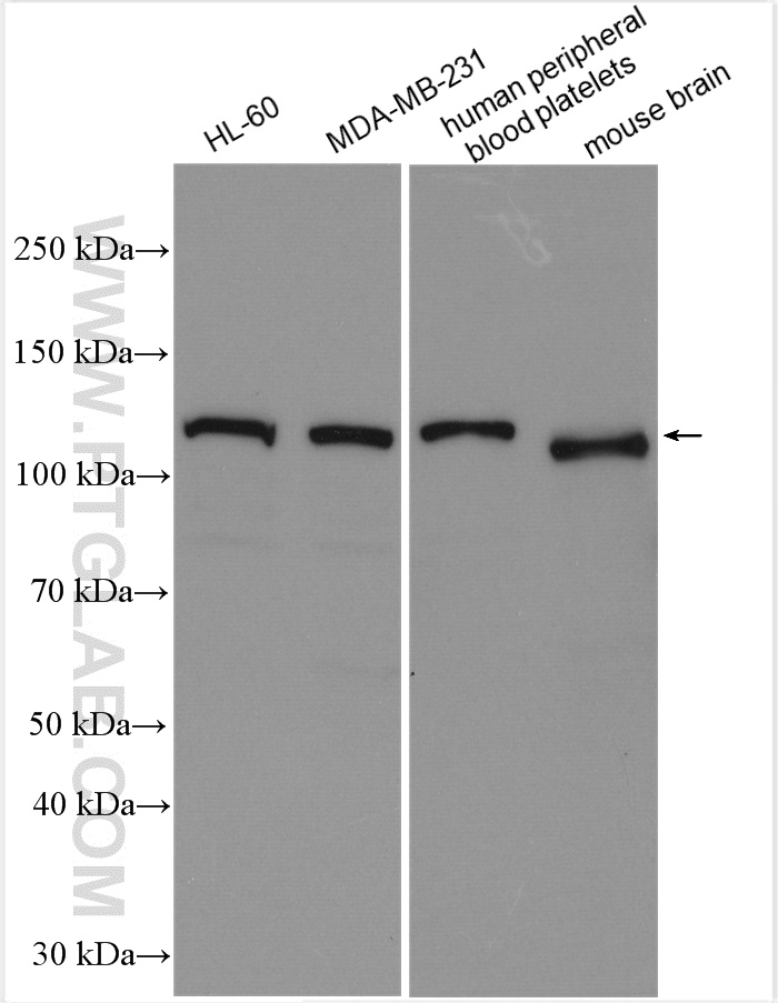 WB analysis using 14605-1-AP