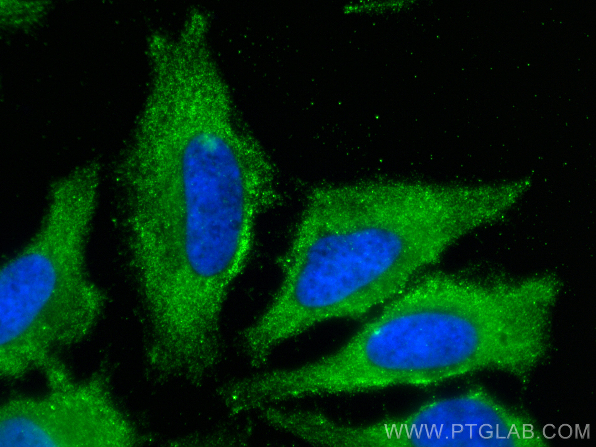 IF Staining of HeLa using 68209-1-Ig